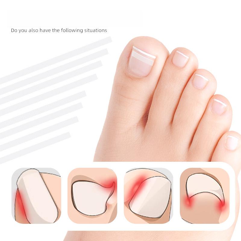 DIY Streifen Positiver Nagelaufkleber Nagelfalz Einrollen Nagel Zugaufkleber Physisches Dehnen Umgekehrte Spannung Eingelegter Nagel Positiver Nagel Patch 5 Stück/Flasche
