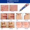 ZB Mole Removal Ointment Skin Care Mild Ingredients Collagen Daily Skin Care