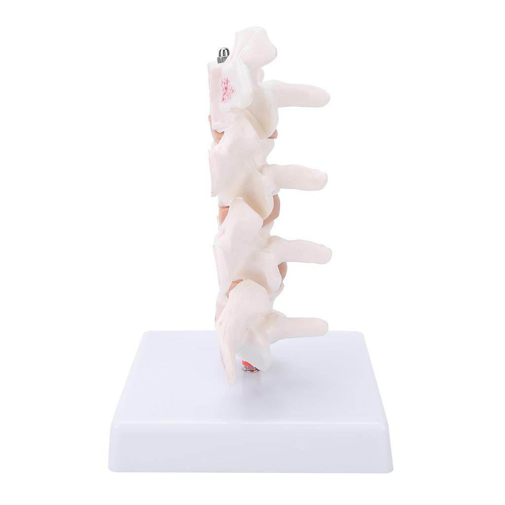 Professional Osteoporosis Model Human Anatomical Spine Model for Teaching Demonstration