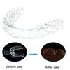 2PCS Thermoplastic Dental Night Guards - Anti-Grinding & Teeth Protection, Customizable Fit for Bruxism & TMJ Relief
