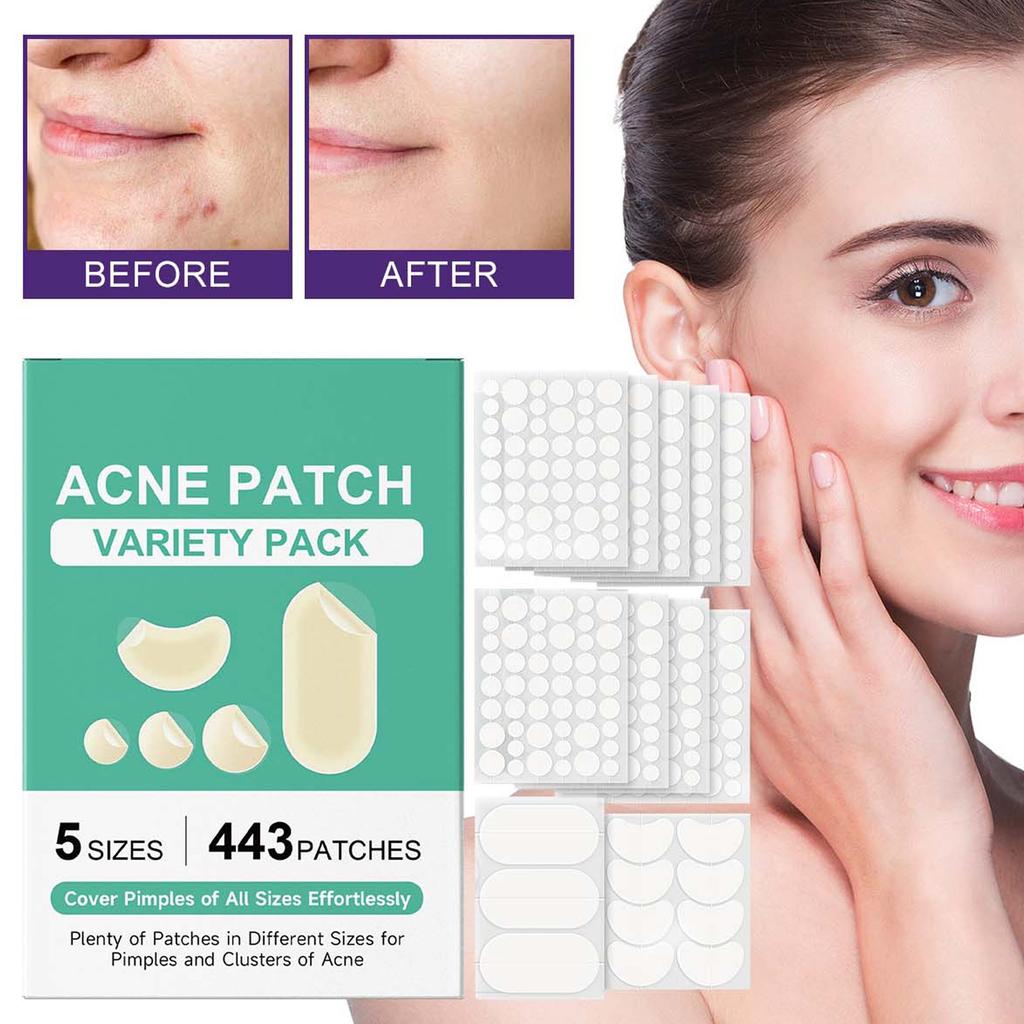 Pickelpflaster für das Gesicht, Pickelabdeckungen, Hydrokolloide Akne-Pflaster Pickelabdeck-Aufkleber 4 Größen Mit Teebaumöl, Hedyotis Alba-Extrakt