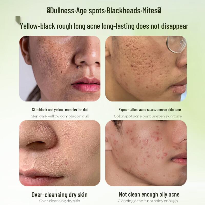 HIEUAILR German Whitening & Brightening Amino Acid Cleanser