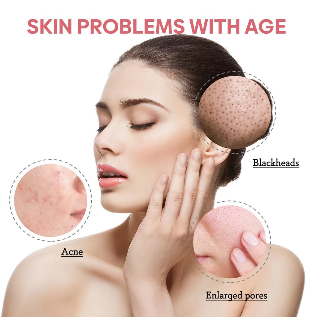 Jaysuing 5 In 1 Cleansing Mousse For Deep Pore Cleansing And Oil Control 60ml