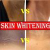 Retinol Whitening Cream Private Parts Underarm Bleaching Neck Lift Firm Butt Knee Brighten Inner Thigh Dark Remove Melanin 60g