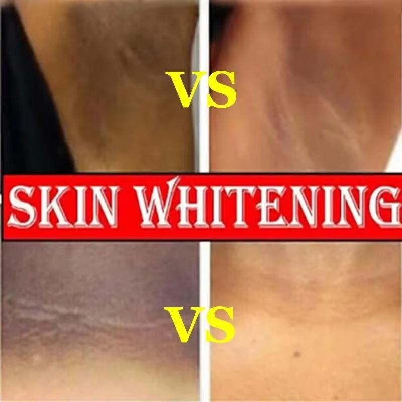Retinol Whitening Cream Private Parts Underarm Bleaching Neck Lift Firm Butt Knee Brighten Inner Thigh Dark Remove Melanin 60g