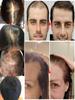 Huile de croissance capillaire entièrement naturelle pour rendre les cheveux plus épais et plus longs et stimuler la croissance des cheveux Produits capillaires Huile de croissance pour femmes noires