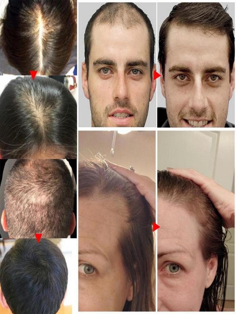 Huile de croissance capillaire entièrement naturelle pour rendre les cheveux plus épais et plus longs et stimuler la croissance des cheveux Produits capillaires Huile de croissance pour femmes noires