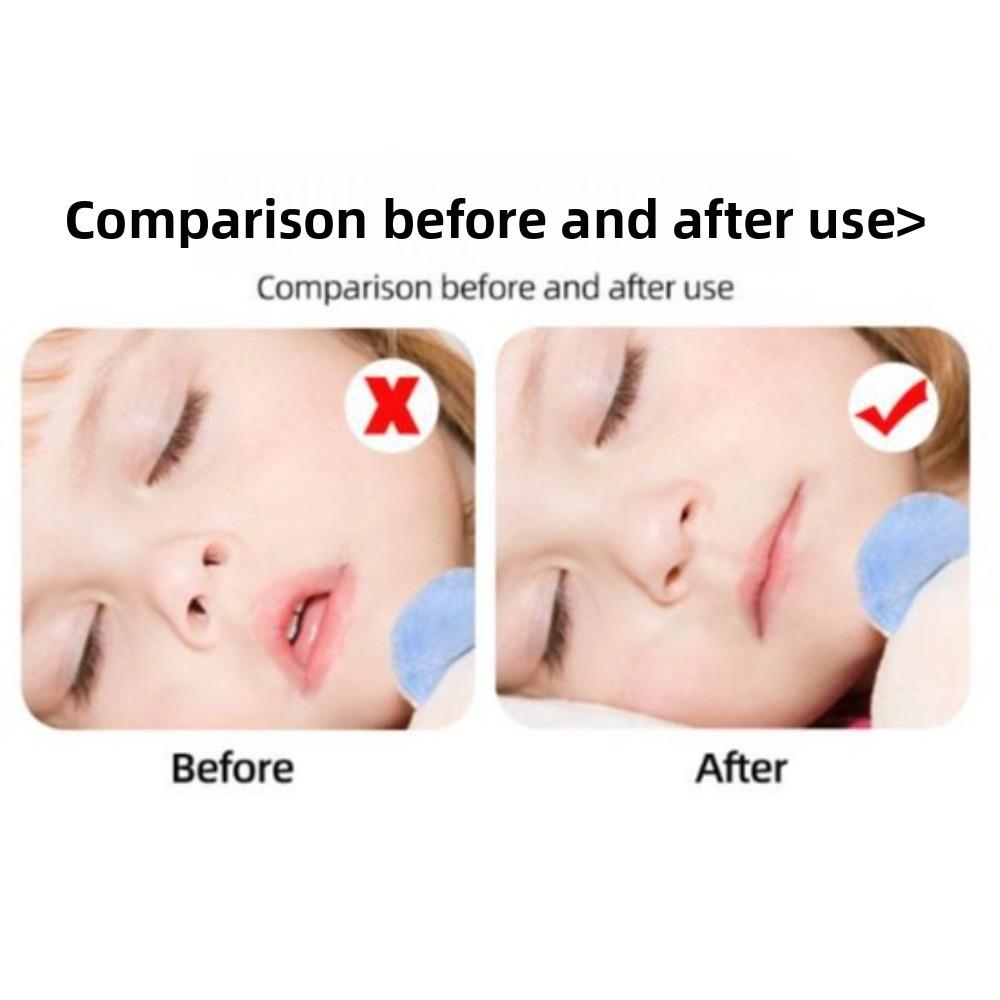 Mandibular Correction Anti-Snoring Mouth Tape Shut Up Stickers  Kids/Children