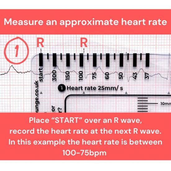 EKG-7-Stufen-Lineal zur Interpretation von Elektrokardiogrammen, transparente EKG-Linealkarte, EKG-Taschentool, tragbares Elektrokardiogramm-Referenzhandbuch für Studenten