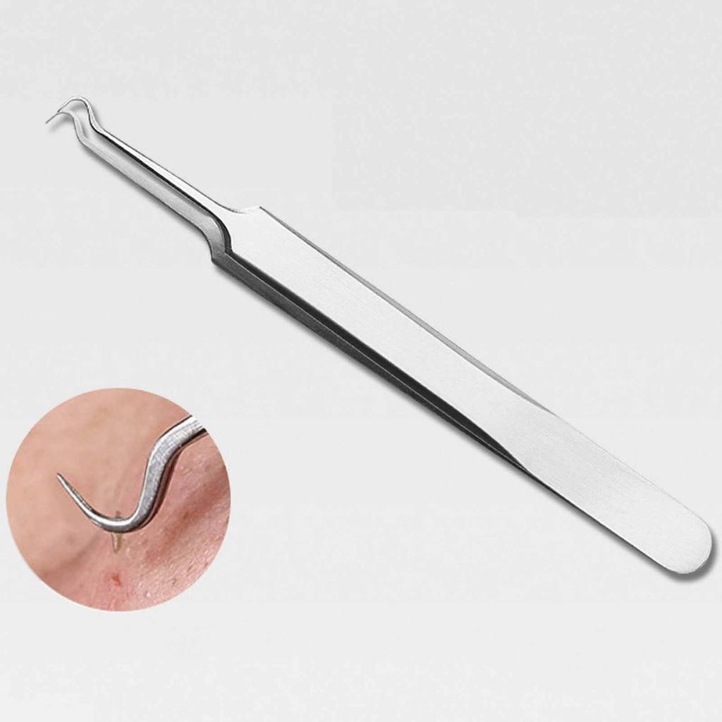 Stainless Steel Acne Extractor Tool for Blackheads and Pimples