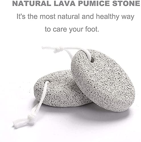 pepplo Natural Pumice Stone for Feet, 1 PCS Lava Pedicure Tools Hard Skin Callus Remover for Feet and Hands - Natural Foot File Exfoliation to Re