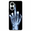 For Huawei Nova 10 SE Case 10SE Shockproof Soft Silicone TPU Back Cover For Huawei Nova 10 SE Phone Cases Nova10 SE Coque Fundas