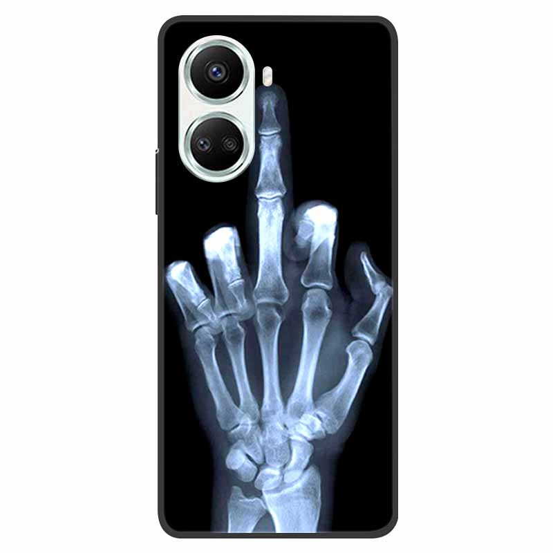 For Huawei Nova 10 SE Case 10SE Shockproof Soft Silicone TPU Back Cover For Huawei Nova 10 SE Phone Cases Nova10 SE Coque Fundas