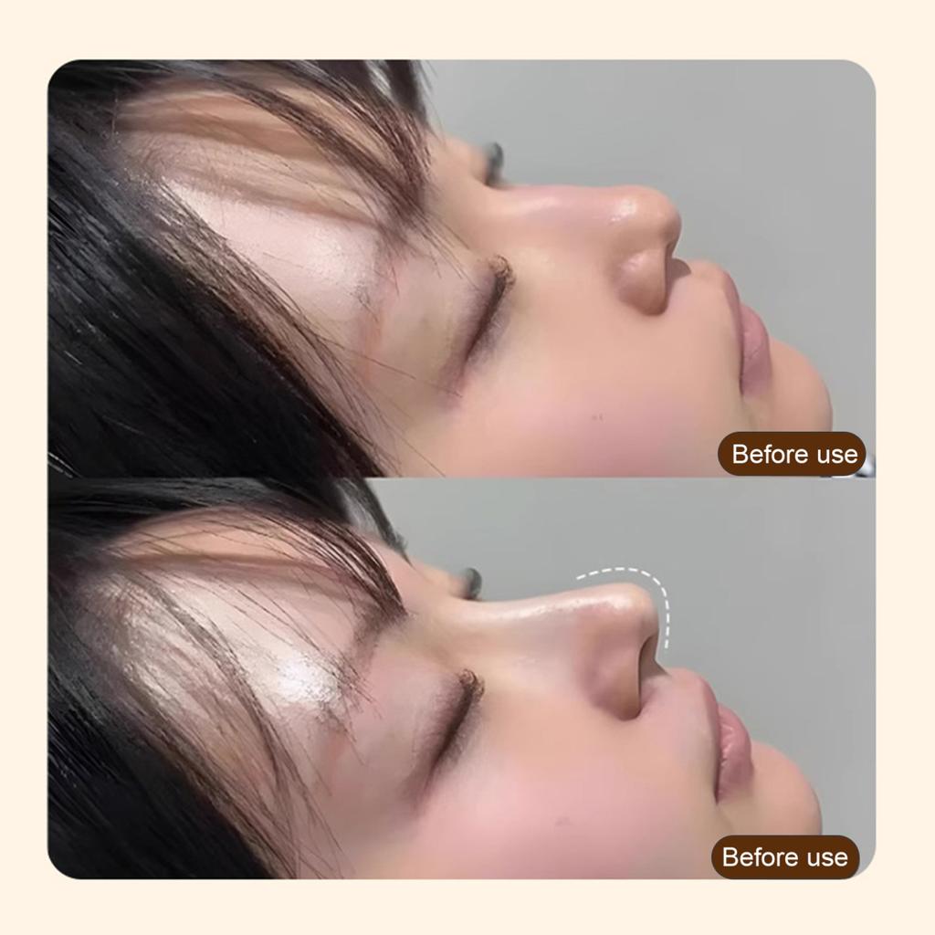 1/2Pcs Thermoplastic Nasal Splints Trapezoid Nose Brace External Nasal Support for Fracture Rhinoplasty Surgery ENT Immobilization