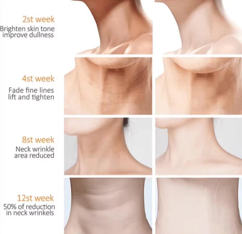 Neck Lines Collagen Cream Eliminate Neck Fine Lines Anti-Aging Lift Firm Eliminate Double Chin Rejuvenation Skin Care Products