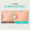 OBgE Pore Zero Peeling Toner 310ml cica niacinamide for sensitive and dark High-concentration skin, dullness, sebum, spots.