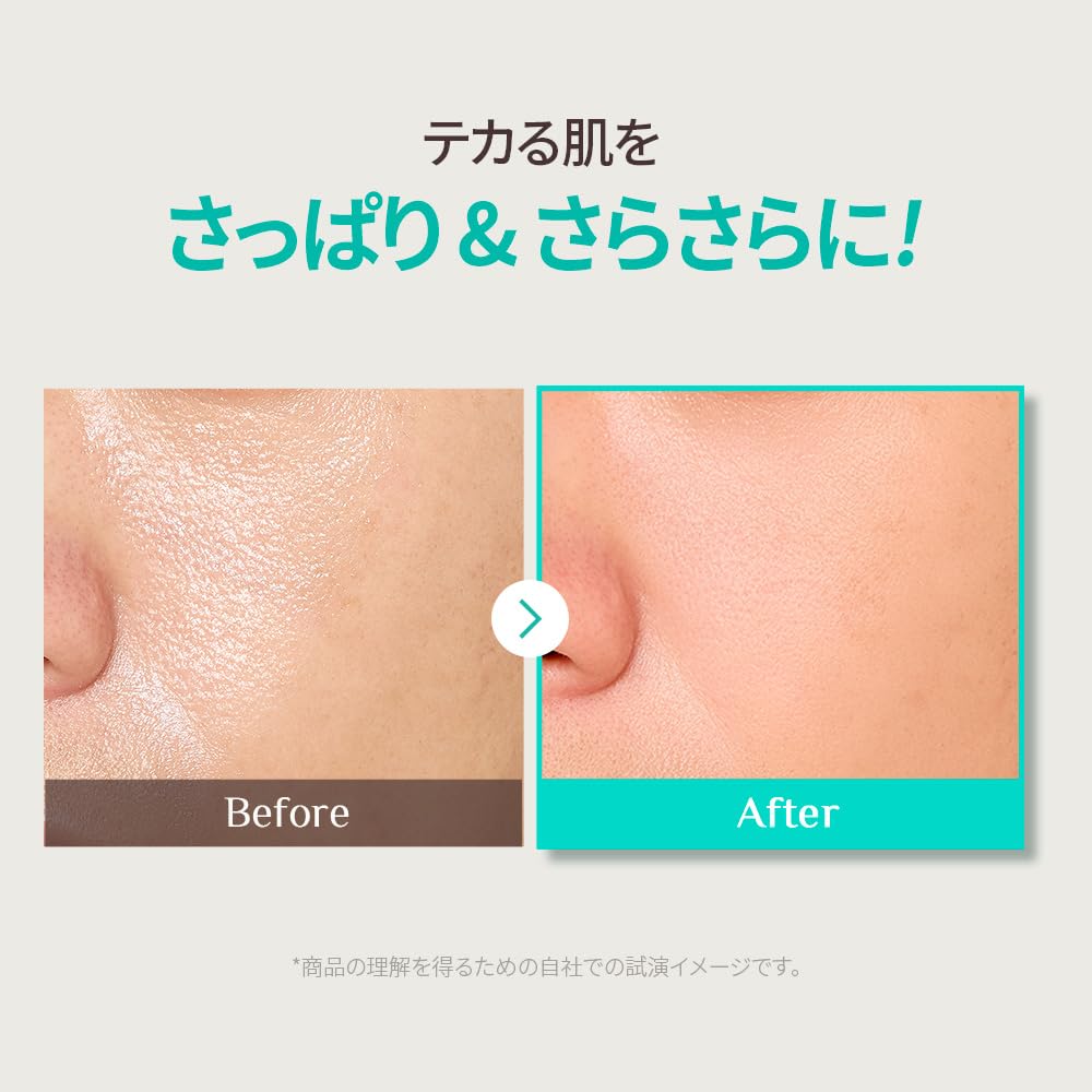 OBgE Pore Zero Peeling Toner 310ml cica niacinamide for sensitive and dark High-concentration skin, dullness, sebum, spots.