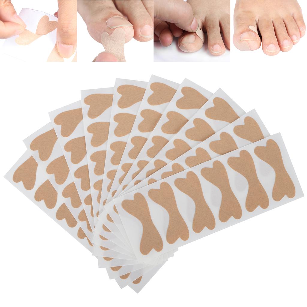 Profesionální náplast na opravu nehtů Sada nálepek na opravu zarostlých nehtů Péče o nohy
