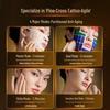 Migoo RF Beauty Device Collagen Cannon S2 CN Plug (adapter Included)