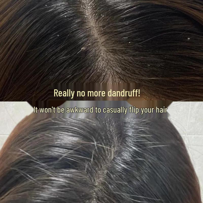 Spes Myrrh Dandruff & Oil Control Shampoo