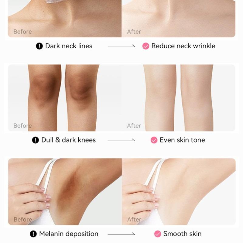 LAIKOU Japan Sakura Achsel-Aufhellungscreme, feuchtigkeitsspendende Aufhellung, 30 g