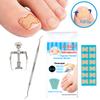 Ingrown Nail Correction Kit Ingrown Toenail Stickers Toe Nail Clamp & Lifter Straightening Treatment Recover Corrector
