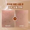    Arte [1+1 Nmn Rapid Pore Ampoule] Arte Pore Cell Programming Ampoule Duo Project Ampoule Single