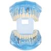 Dental Teeth Model Acrylic Blue Transparent Teaching Demonstration Simulation Teeth Model