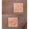 FULLight - Re:dence Tone & Spot Corrector Ampoule