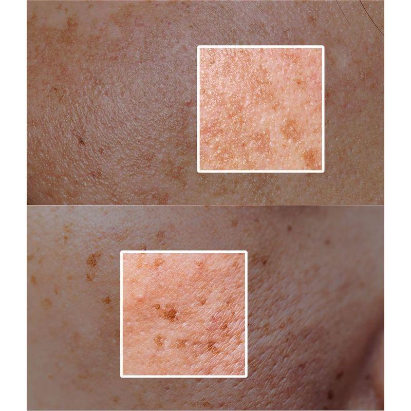 FULLight - Re:dence Tone & Spot Corrector Ampoule