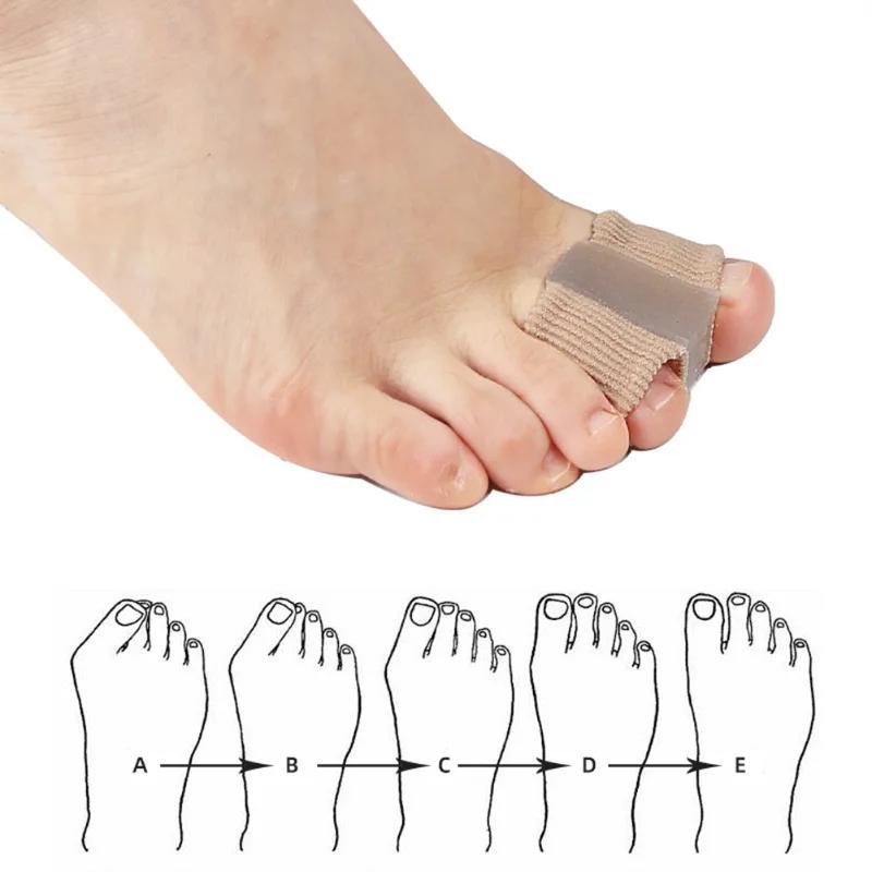 1PCS Toe Separator Hallux Valgus Bunion Corrector Orthotics Night Foot Care Thumb Daily Big Bone Tool Pedicure Feet Straightener