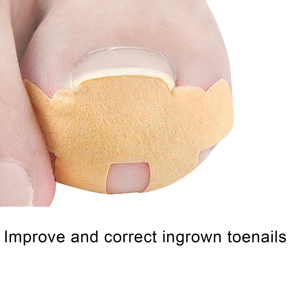 Ingrown Toenail Corrector Stickers Pedicure Toe Nail Care Correction Bandage Patch