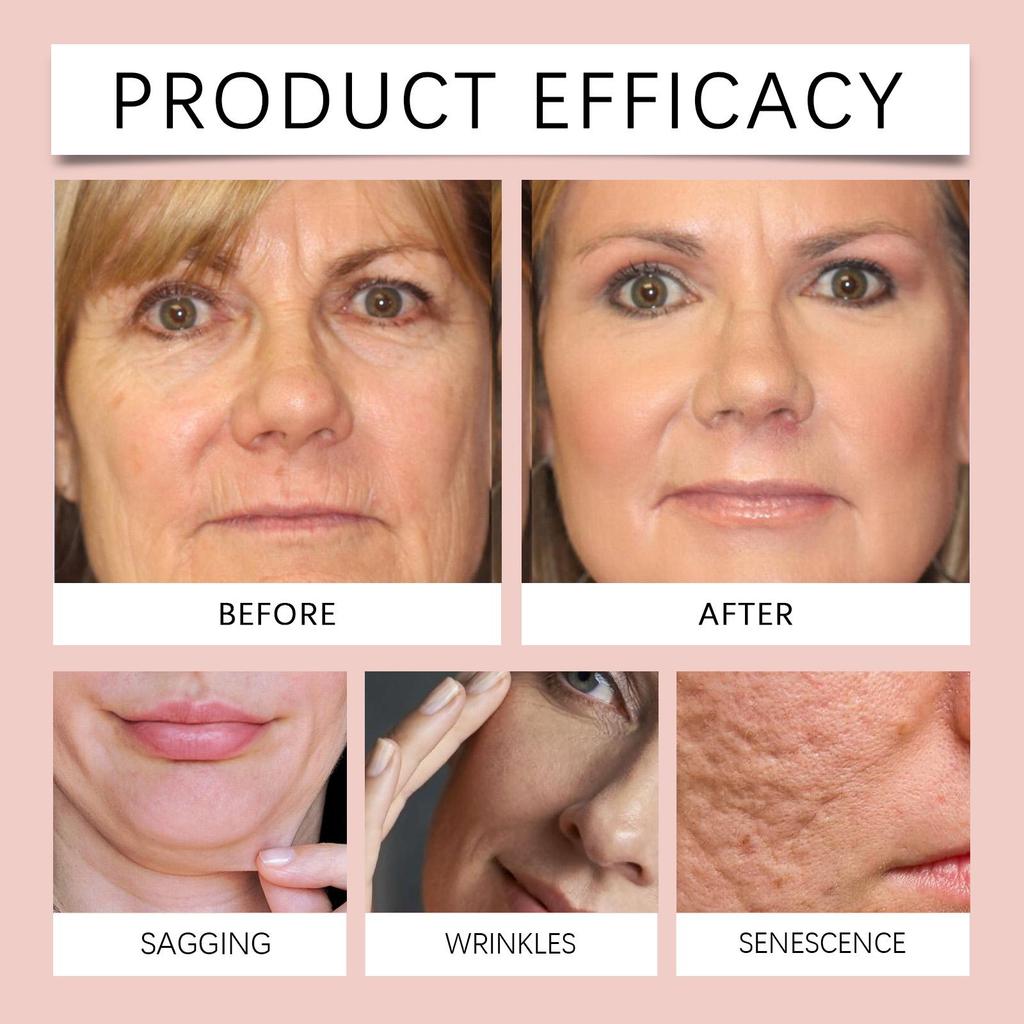 Hoygi Collagen Peel-Off Mask, moisturizes and hydrates, nourishes and firms the skin, cleanses and cares for the skin, suitable for the face, 1 set