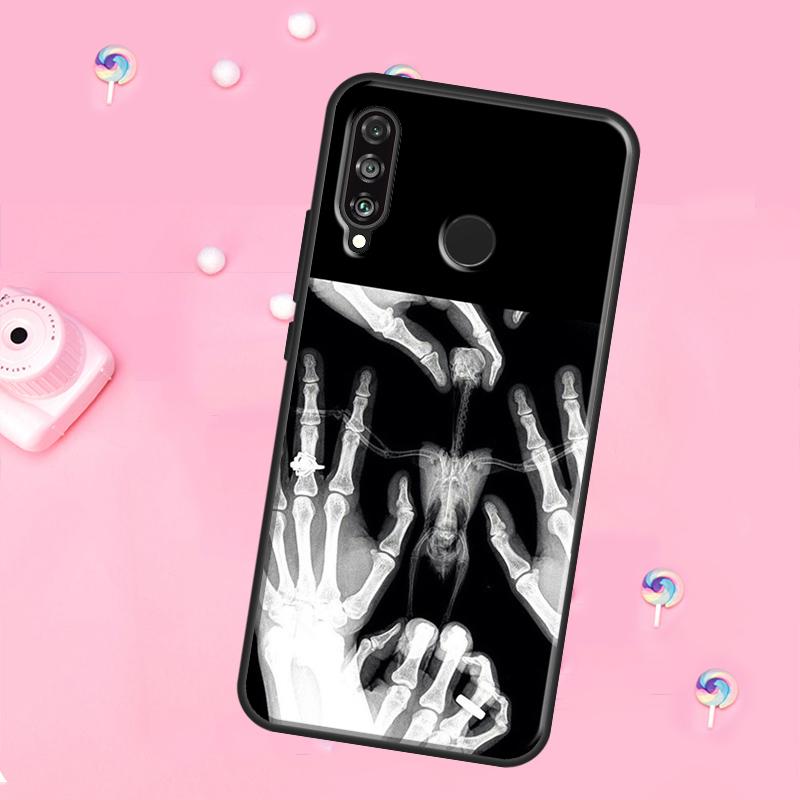 xray art aesthetic Skull For Huawei Nova 10 9 SE 3i 7i 8i 11i 12i Y73 Y90 Y70 Y72 Y61 Y91 P60 Pro P30 P40 Lite Case