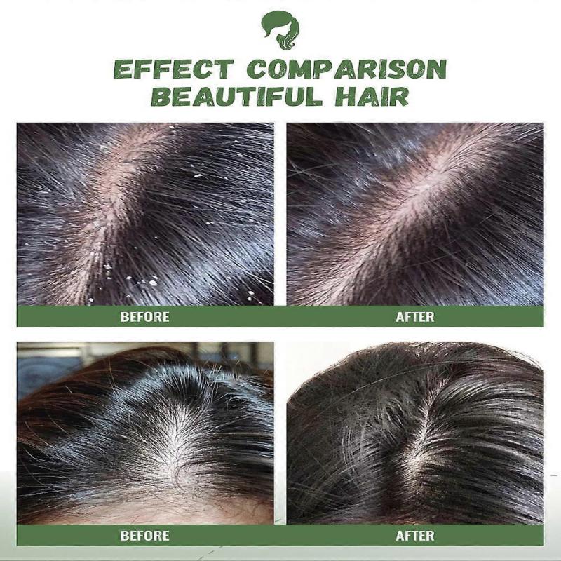 Teebaum Shampoo, Ölkontrolle und Anti-Schuppen Shampoo Linderung von Juckreiz für die Kopfhaut, Pflegende Haarpflege mit Teebaumöl, Pfefferminze und Lavendel