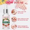 Strawberry Cuticle Oil-Softening And Deeply Moisturizing-Herbal Extract Essential Oil-Preventing Nail Cracking, 30ml