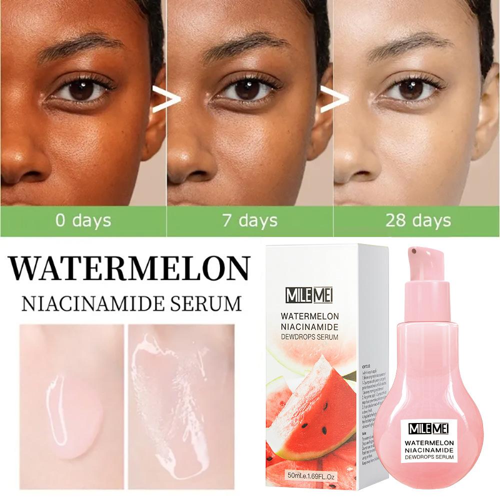 Watermelon Nicotinamide Whitening Moisturizing and Nourishing Essence Facial Skin Care Cream