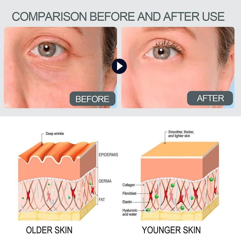Collagen Boost Anti-Aging Essence, Wrinkle Removing And Whitening Serum