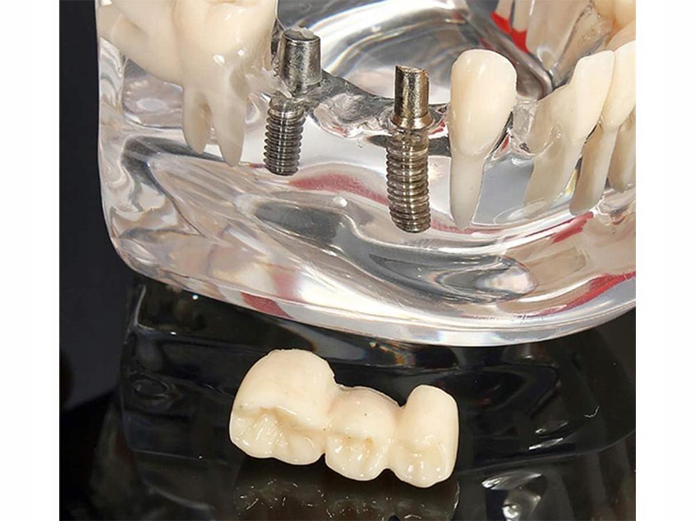 Dental Model 2 White (100) Gab_B