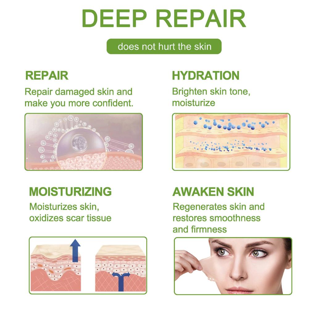 1 stk 150CM Silikongel Arrark Plaster Behandling Fjerning Tape Akne Traume Brannarr Dekke Hudreparasjon Seksjon Øre Skjønnhet