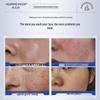 HURMEVKOR 377 Brightening Cleansing Mousse