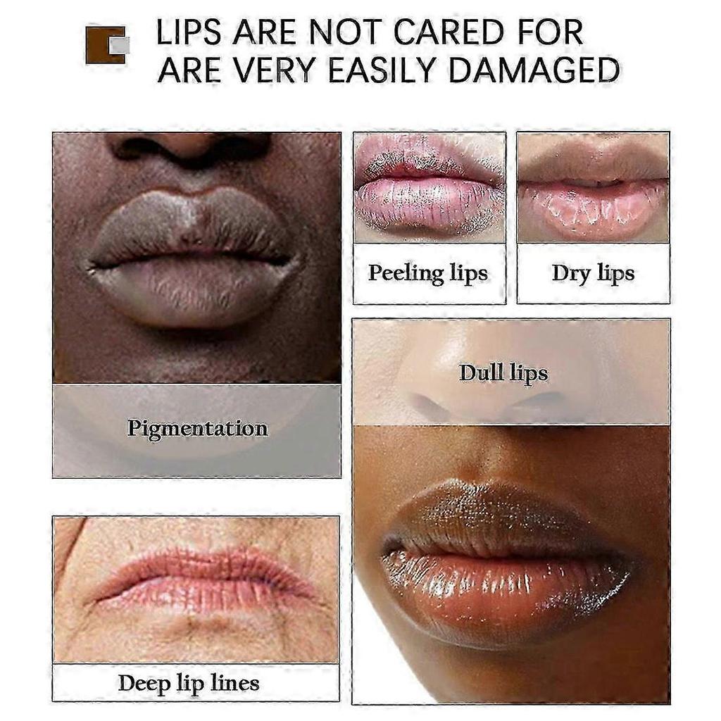 Yoxier Lip Lightening Scrub Balm Remove Dull Lips Cream Moisturizing Anti-aging Anti-cracking