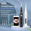 Advanced Visual Ultrasonic Teeth Cleaner - Removes Dental Calculus, Tartar, Tooth Stains, and Yellowing for a Brighter Smile.