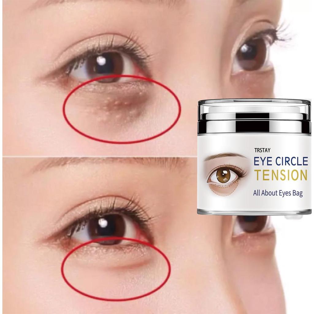 The Gentle Eye Cream Soothes Dry Itchiness Around the Eyes, Moisturizes and Tightens the Skin Around the Eyes
