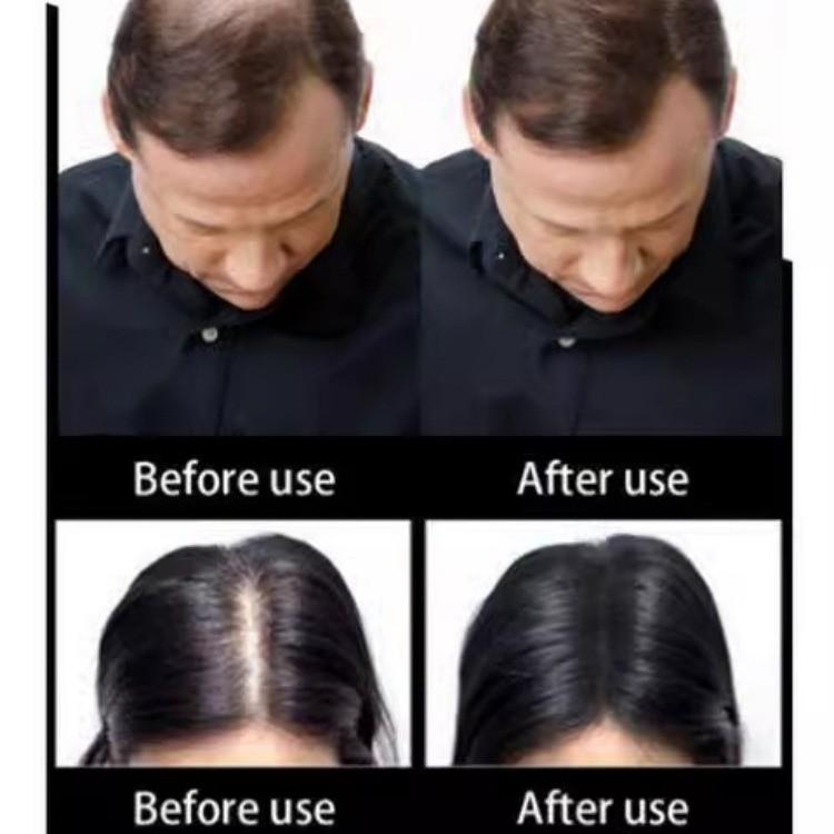 Fibre per Capelli Toppik Volumizzanti Polvere per Capelli Corti Aspetto Naturale