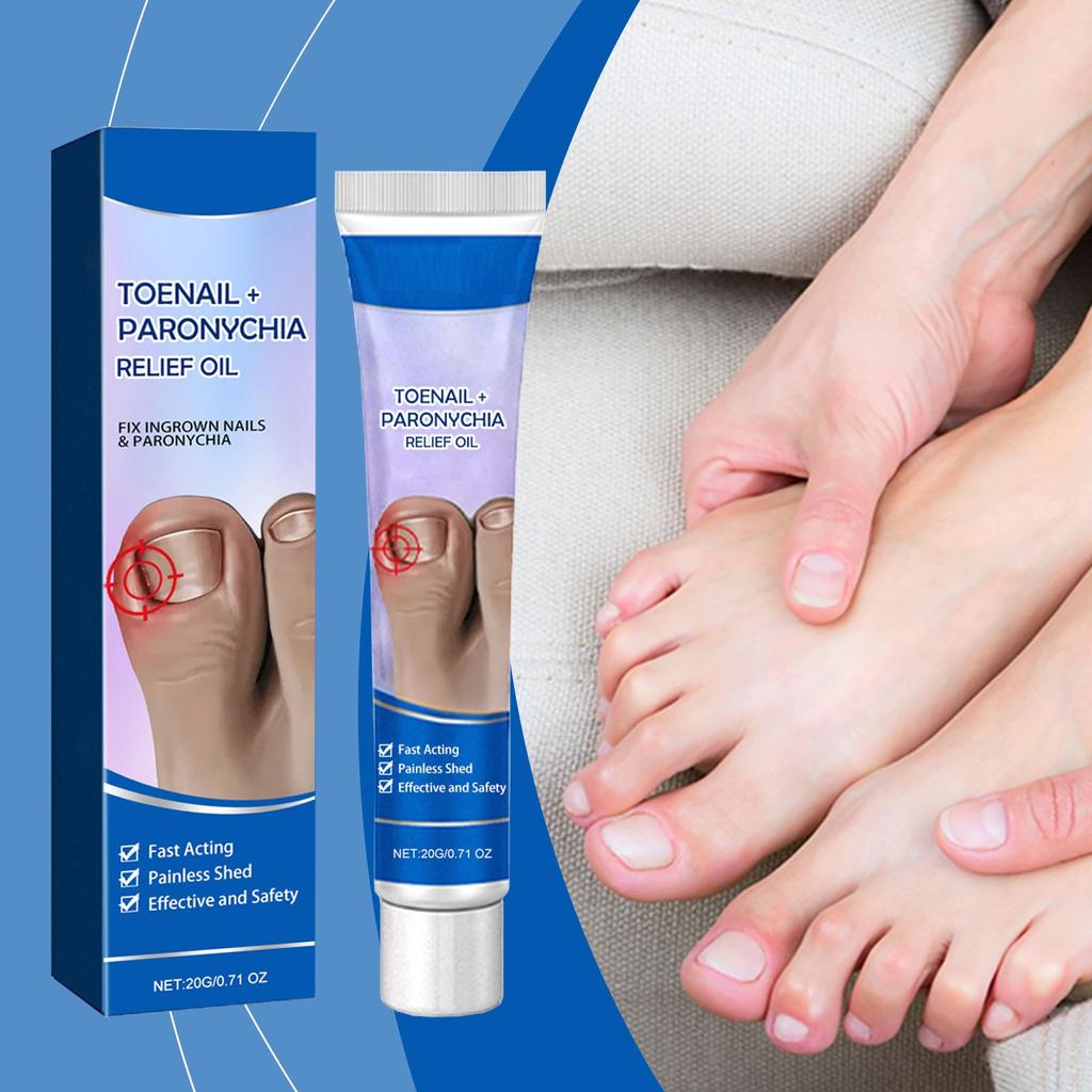 Nail Care Ointment, Moisturizing And Gentle Moisturizing Ointment For Nails
