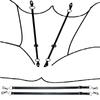 BDSM Labia Spreader Clip Klitoris bradavky na klitoris SM Bondage Spread Pussy Open vagina Stimulator pre ženy Sexuálne hračky pre dospelých