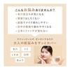 ORBIS You Treatment Cushion Foundation N Refill (with Dedicated Puff) Light 10mL SPF30/PA+++