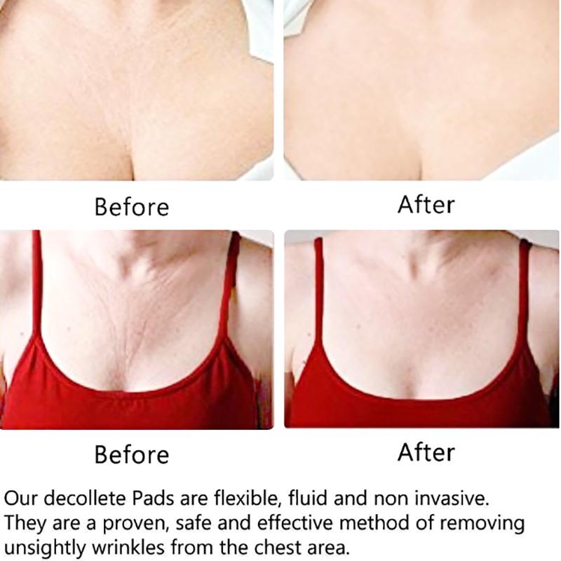 Medical Grade Silicone Overnight Invisible Pad