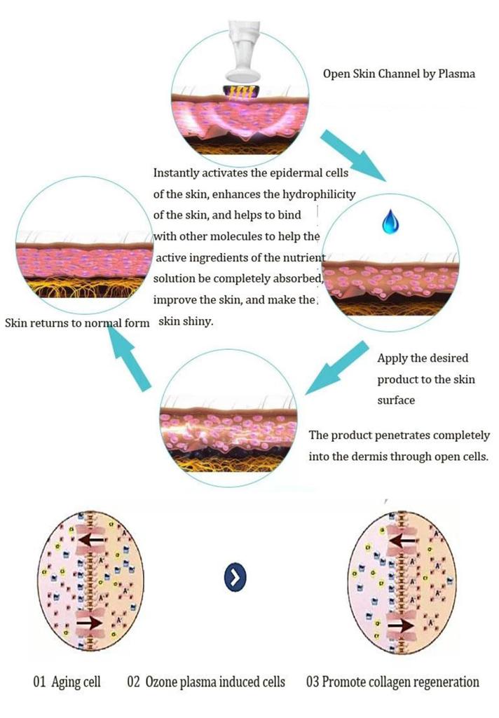 Profesionální ozónové plazmové pero pro zmírnění stárnutí pleti, omlazení pleti, bělení, léčbu akné, plazmové pero